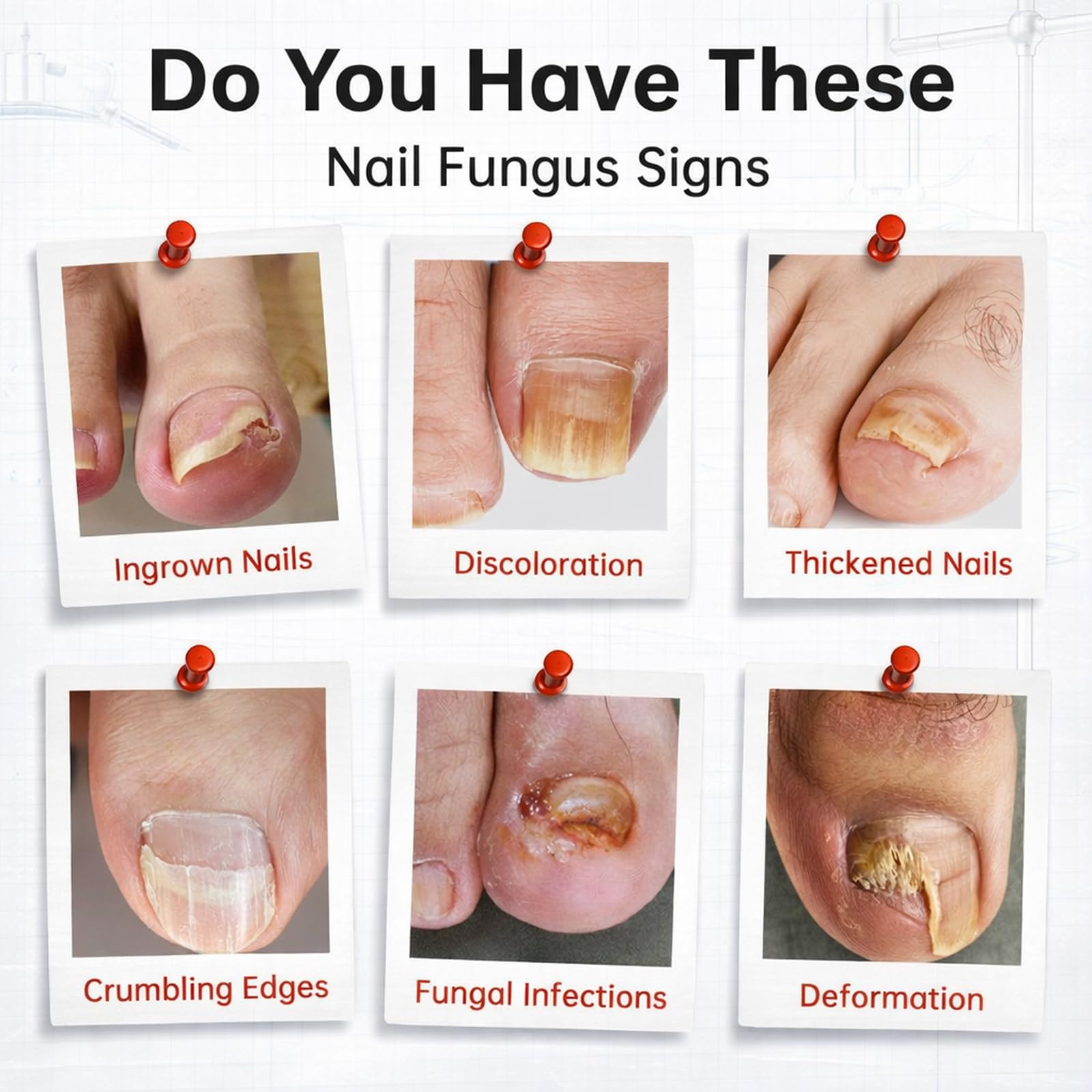 FLYLEAF aplicador rollerball en detalle para aplicación uniforme y sin goteos