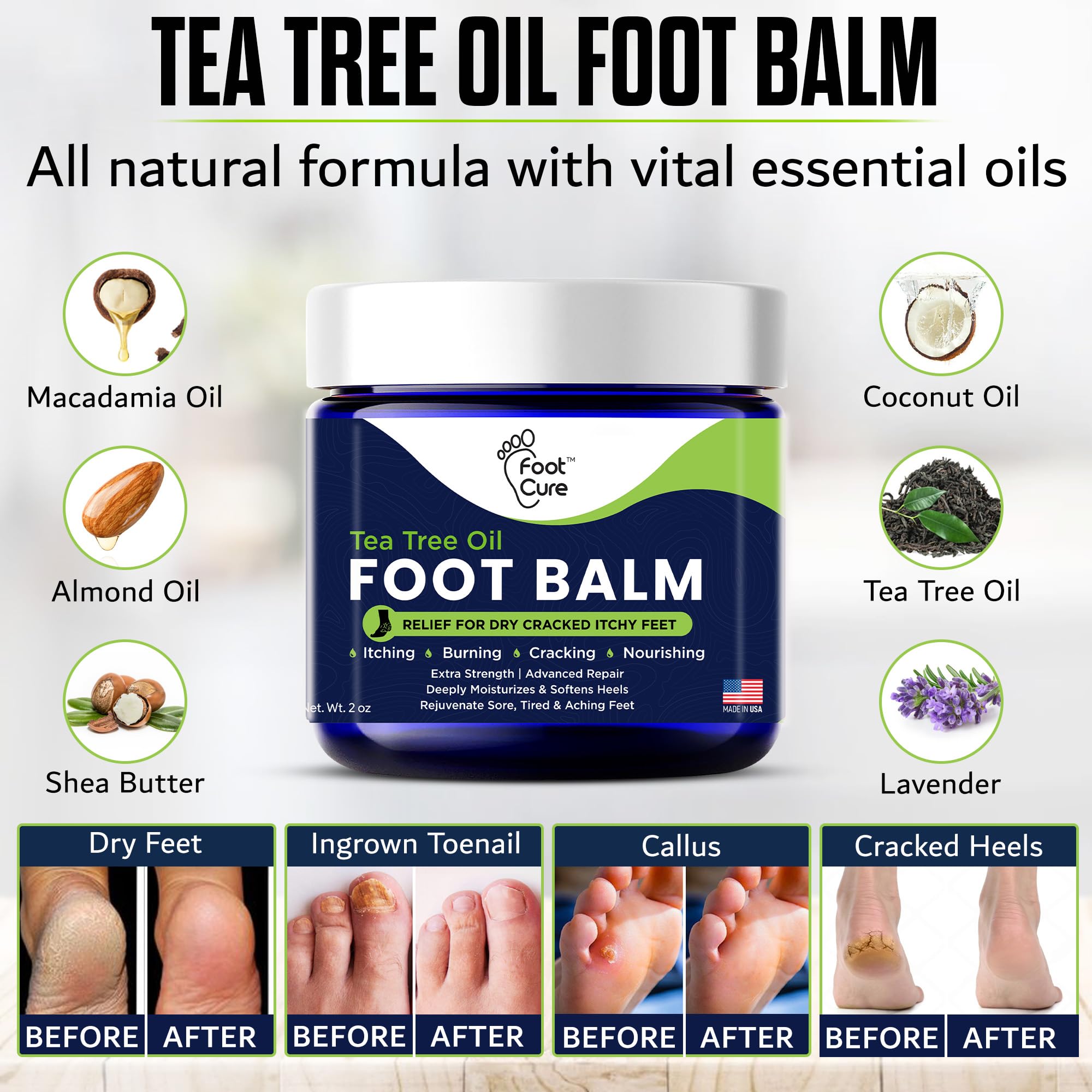 FOOT CURE aplicación en pie para alivio y confort inmediato