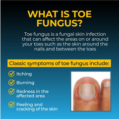 Fungi-Nail aplicándose sobre uña del pie para tratamiento localizado