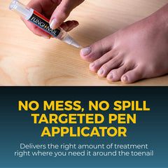 Fungi-Nail pen en mano aplicando terapia antifúngica con facilidad