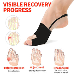 Generic corrector de juanetes dentro de zapatilla deportiva para uso diario cómodo