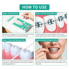 GLI-Smile uso con brackets mostrando entrada bajo arco para limpieza efectiva