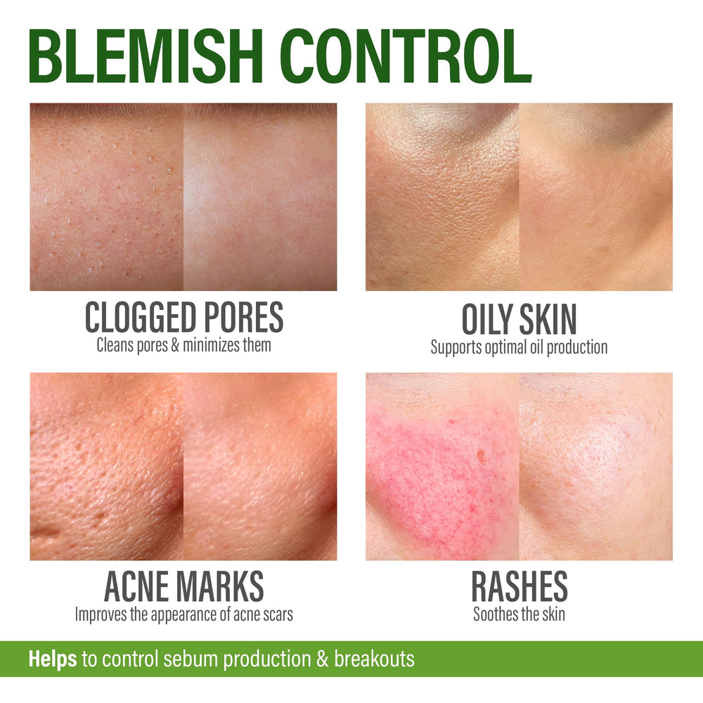 Mano sosteniendo Perfect Skin Pills GRAMRIGHT para comparar tamaño y dosificación