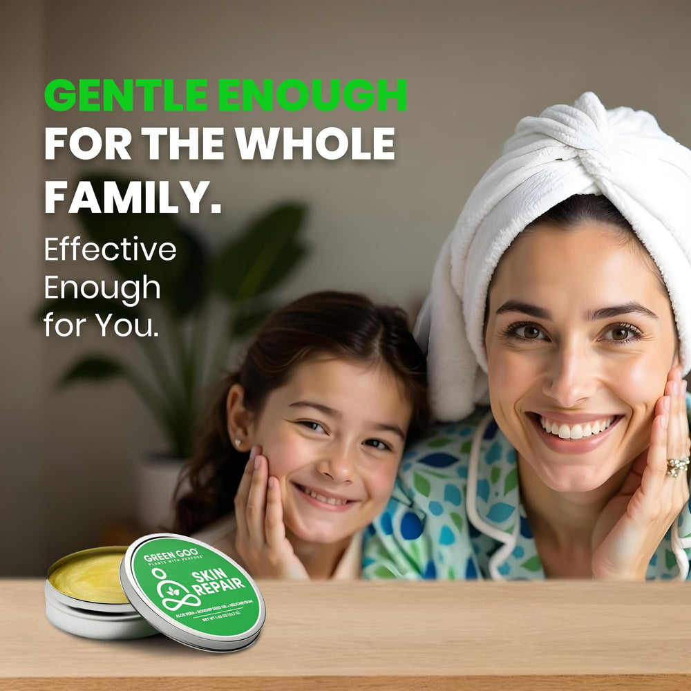 Green Goo aplicación en manos alivia piel seca de forma localizada