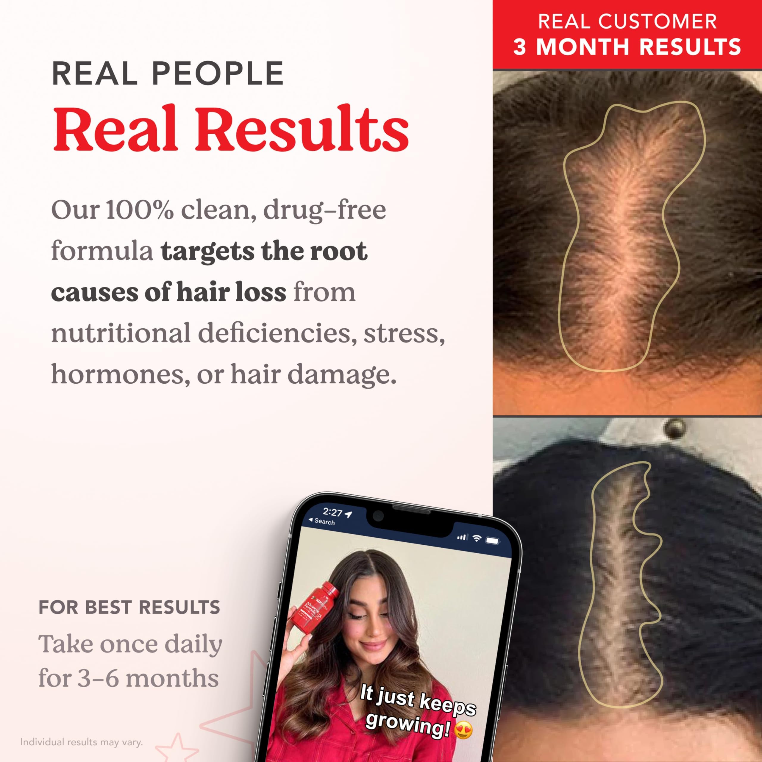 HAIRtamin comparación de tamaño con moneda para referencia práctica