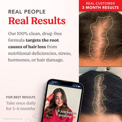 HAIRtamin comparación de tamaño con moneda para referencia práctica