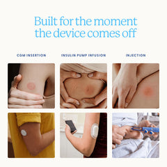 Healthy Sites parche aplicado sobre piel tras retiro de sensor para calma