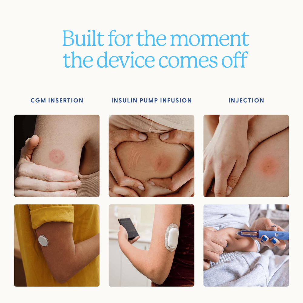 Healthy Sites parche en uso con CGM, mantiene sitio calmado