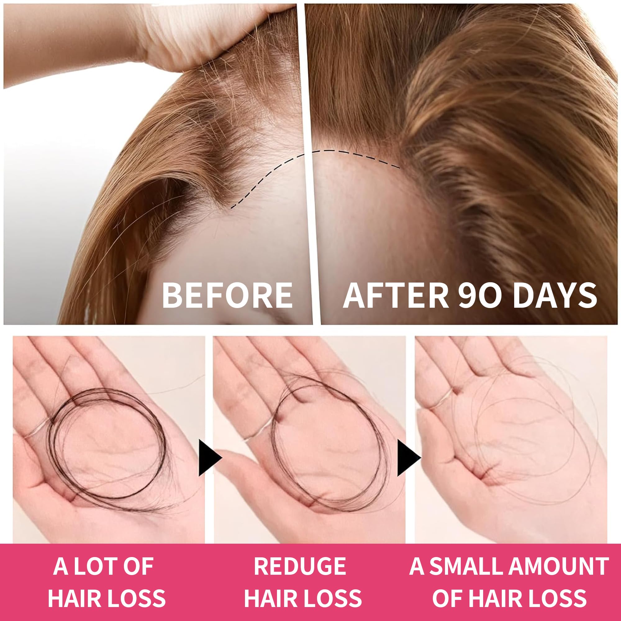 HiPlus ingredientes biotina zinc hierro para nutrición capilar