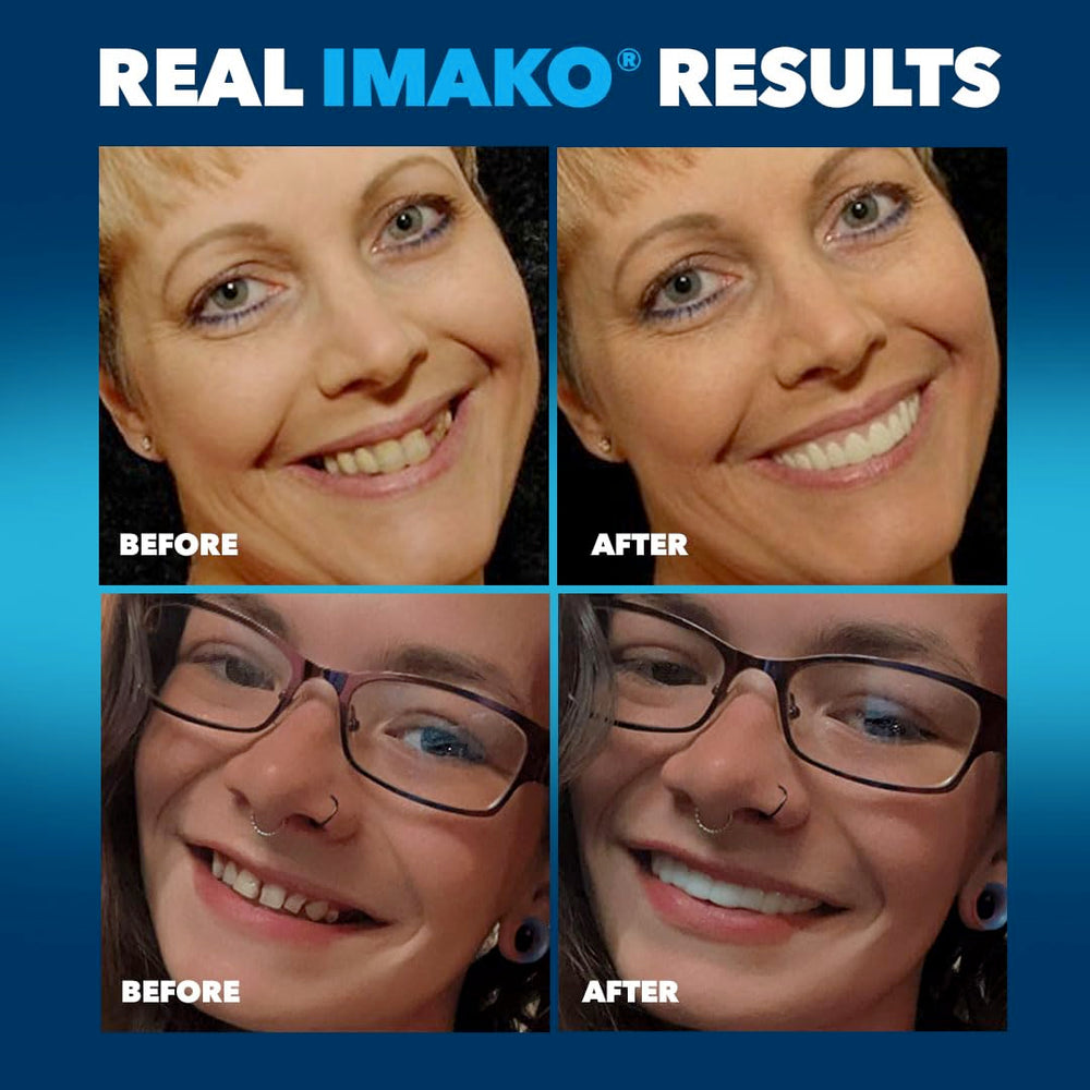Imako fundas junto a regla para comparar tamaño y elegir talla