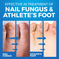 Imperial Feet niebla fina del spray que seca rápido y refresca