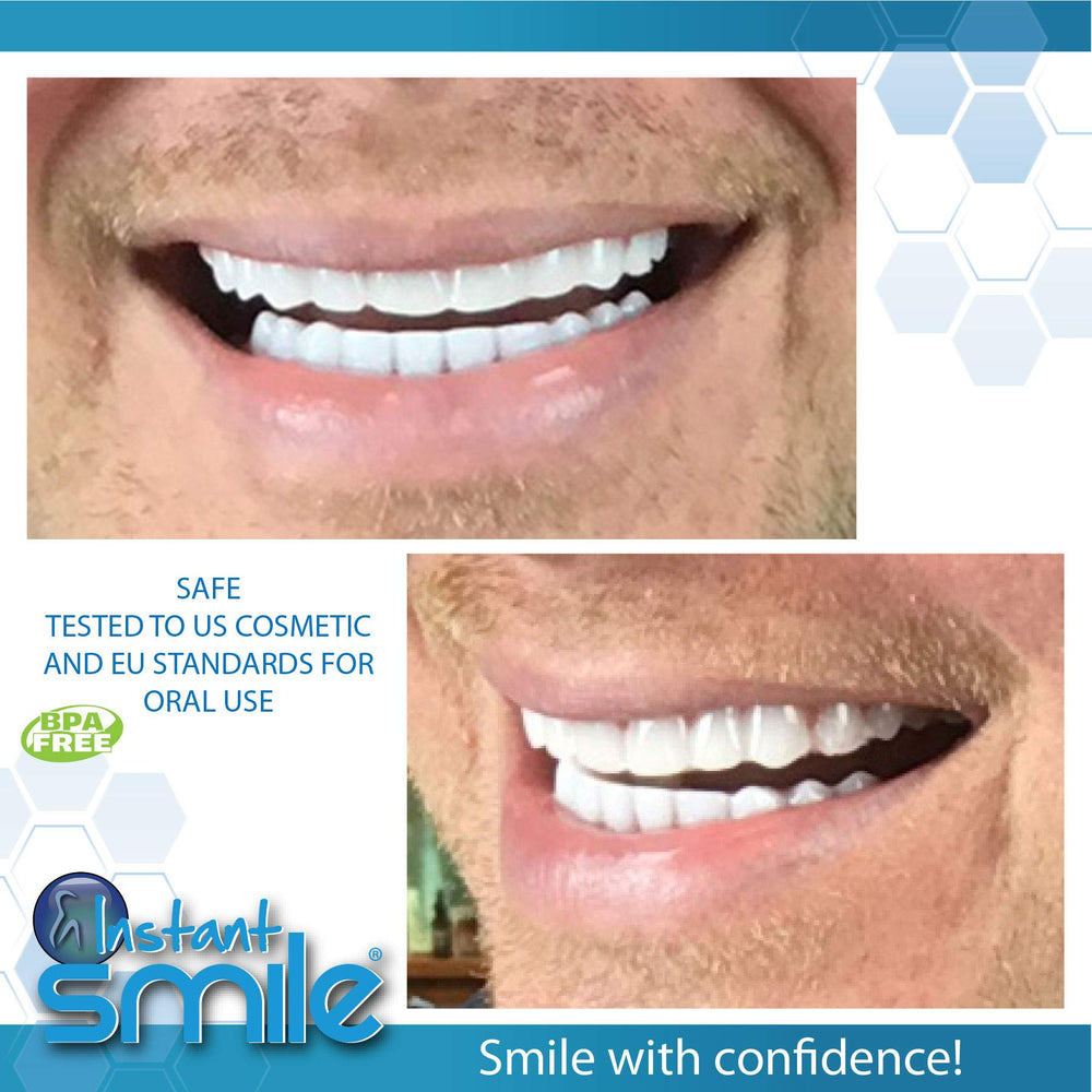 Instant Smile comparativa de tamaño para ver escala y ajuste cómodo