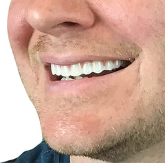 Instant Smile en uso en selfie mostrando sonrisa natural para fotos