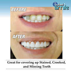 Instant Smile perfil lateral destacando ajuste natural y discreto
