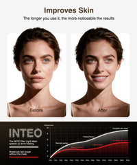 INTEO vista lateral que revela ajuste de correas y ergonomía cómoda