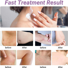 ishancare etiqueta con ingredientes naturales y claridad informativa