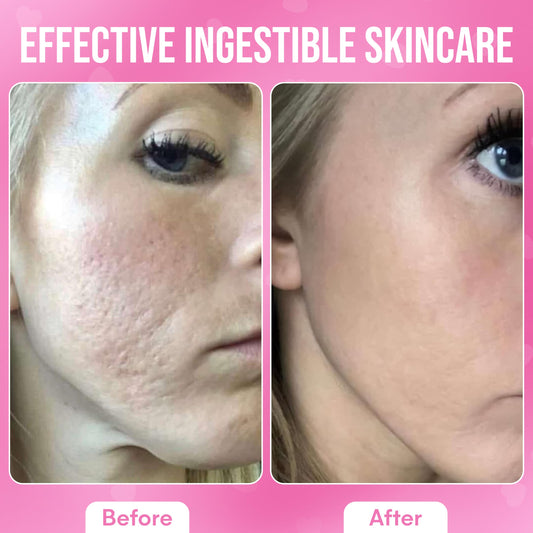 It Girl Vitamins gomitas con colágeno y péptidos para piel más firme.