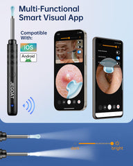 JEGOAT estuche de viaje con otoscopio y accesorios para cuidado auditivo portable