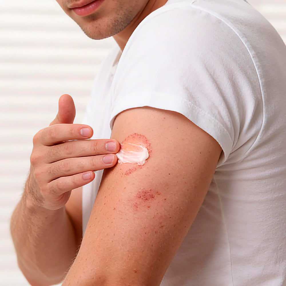 Kerova etiqueta con ingredientes destacando miconazol 2% y confianza