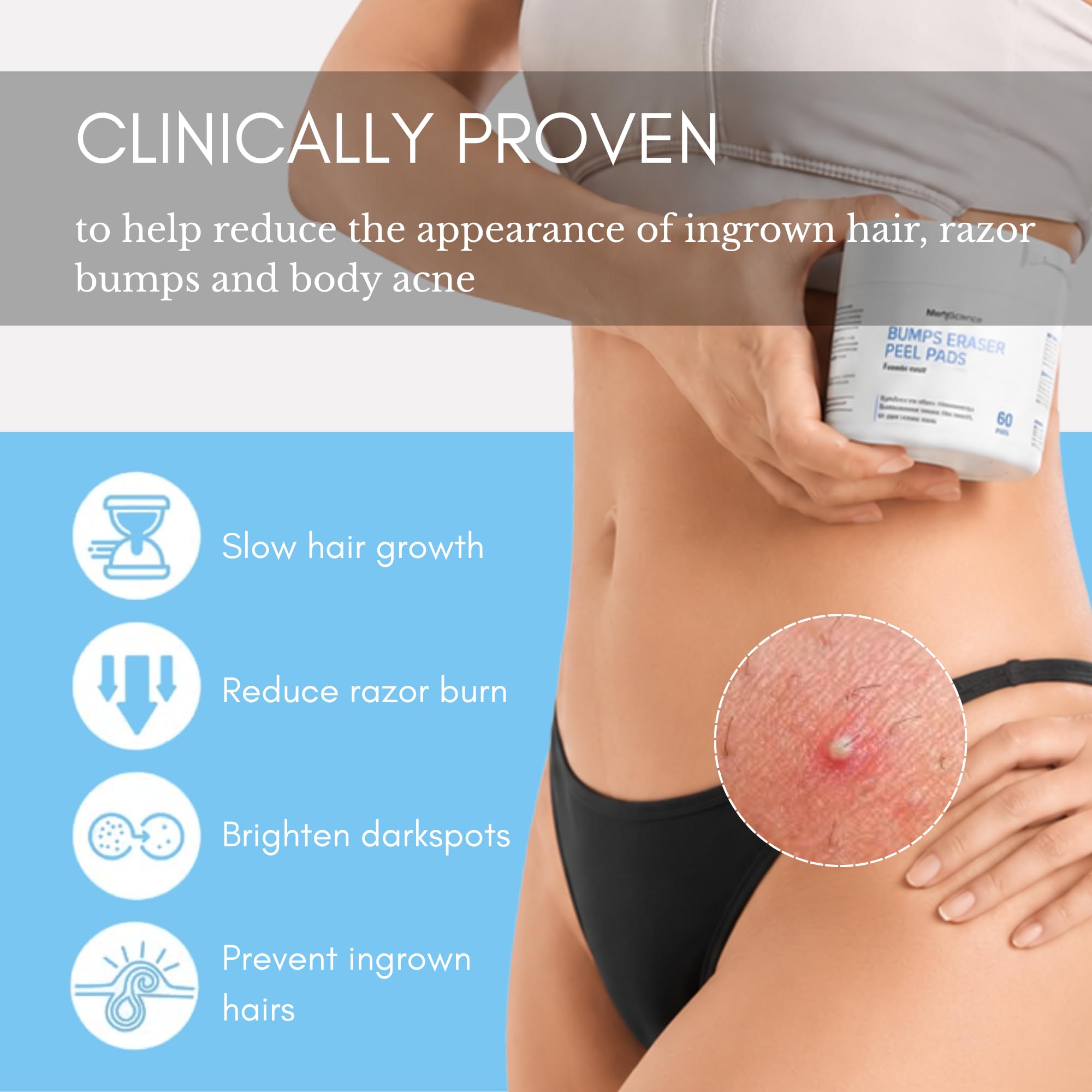 klarifyScience uso en zona de bikini para prevenir vellos enquistados