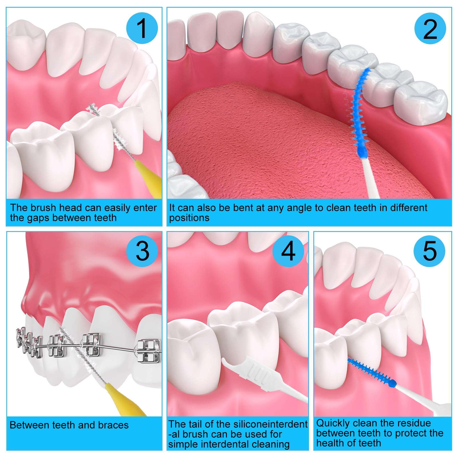 lanjue cepillo interdental usado entre brackets mostrando acceso fácil y limpieza eficaz