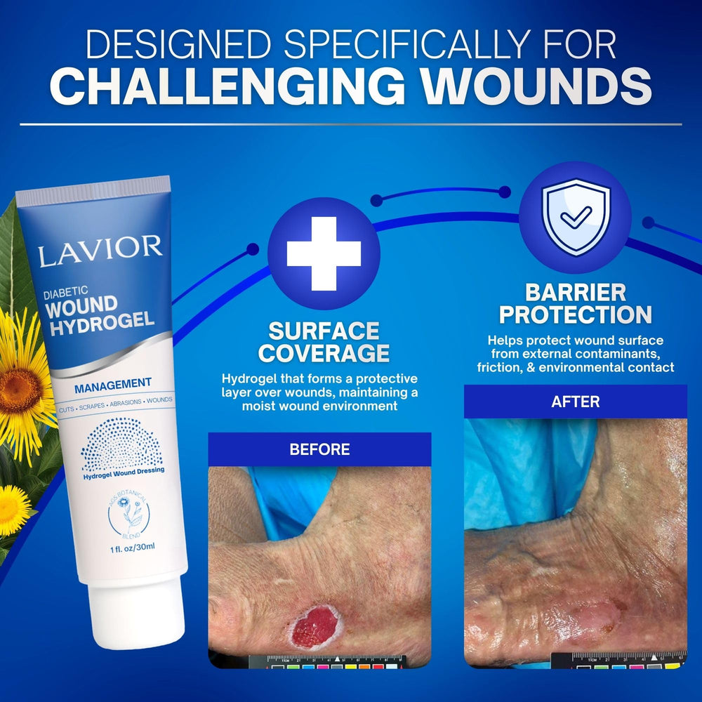 Lavior aplicado alrededor de sitio CGM ofreciendo protección suave