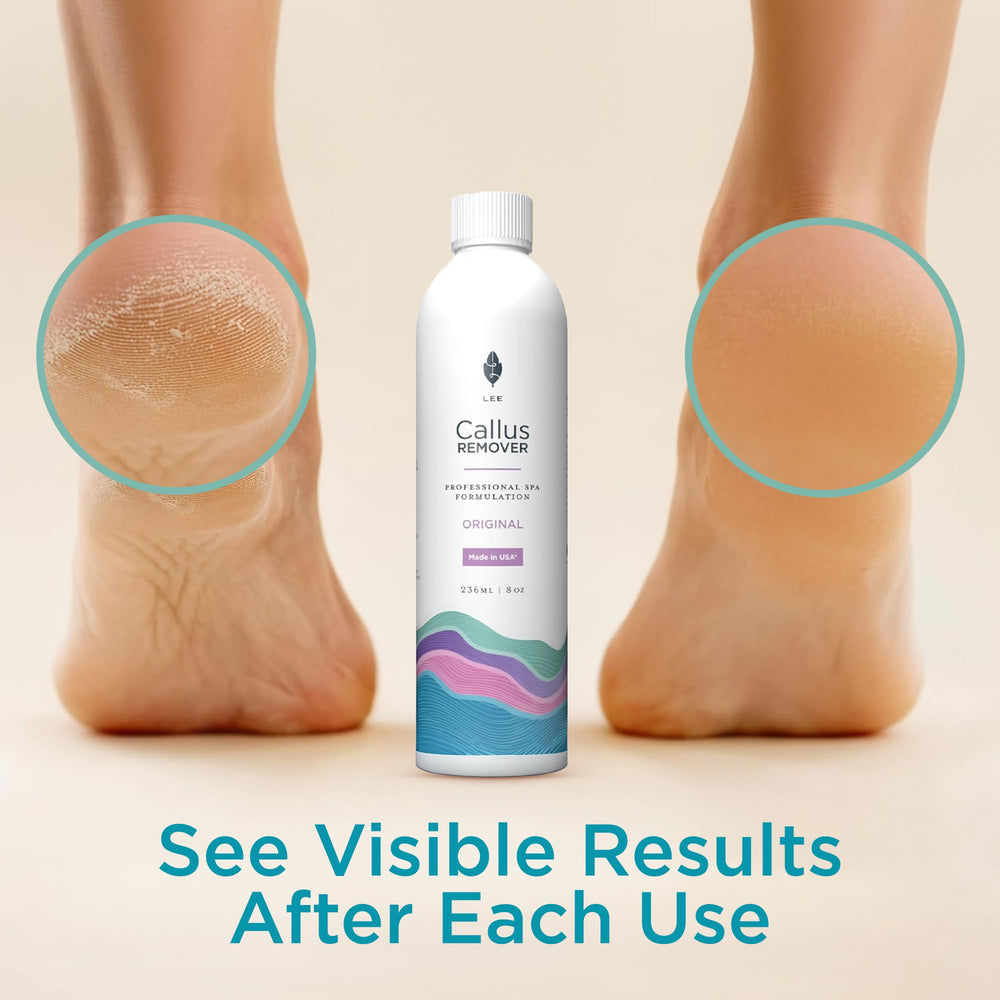 Lee Beauty aplicación del gel en talón para ablandar callos y mejorar confort