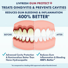 Detalle de la textura en gel de LIVFRESH que facilita limpieza y contacto gingival