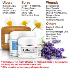 LMNOOP crema aplicada en la mano para aliviar y proteger