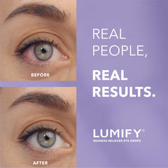 LUMIFY caja abierta con detalle de instrucciones y sello FDA visible
