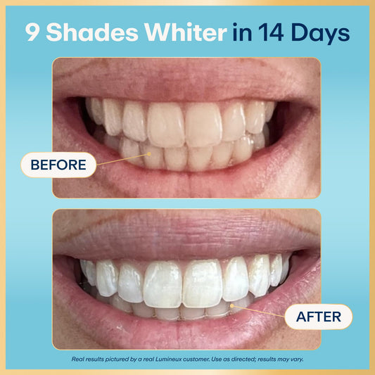 Lumineux tiras blanqueadoras en su empaque abierto y facilidad de uso