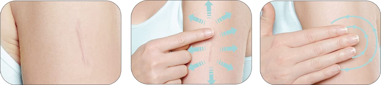Mederma aplicación en pierna demostrando masaje y absorción rápida