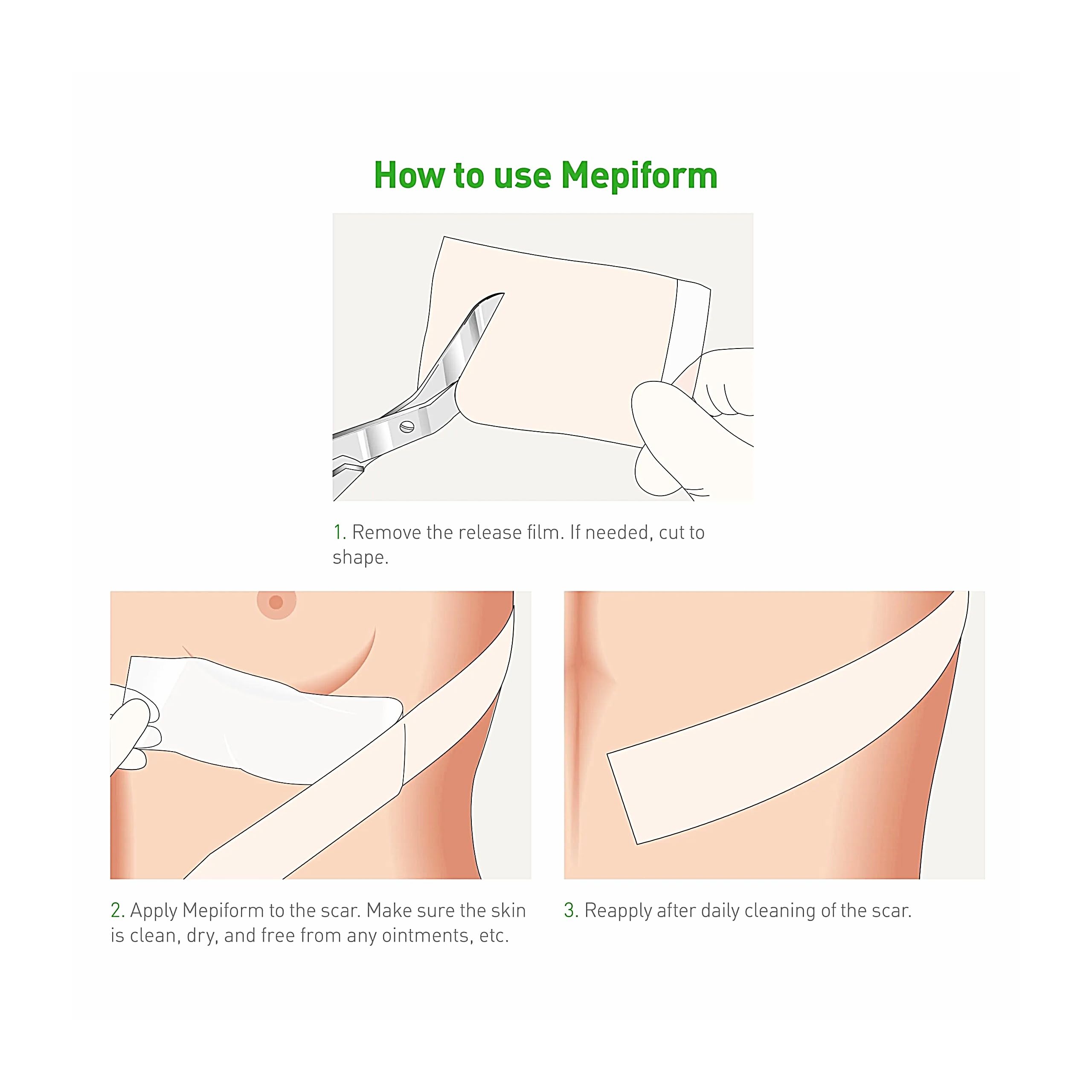 Mepiform sobre brazo en uso, sujeción discreta y protección de la cicatriz
