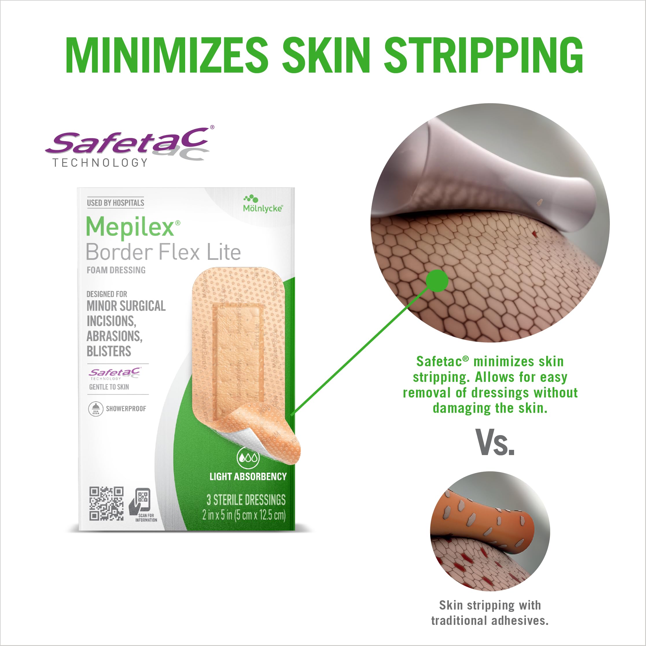 Mepilex borde adhesivo flexible que reduce dolor al retirar