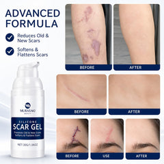 MURASAKI BEAUTY aplicación sobre área de cesárea mostrando suavidad y cuidado