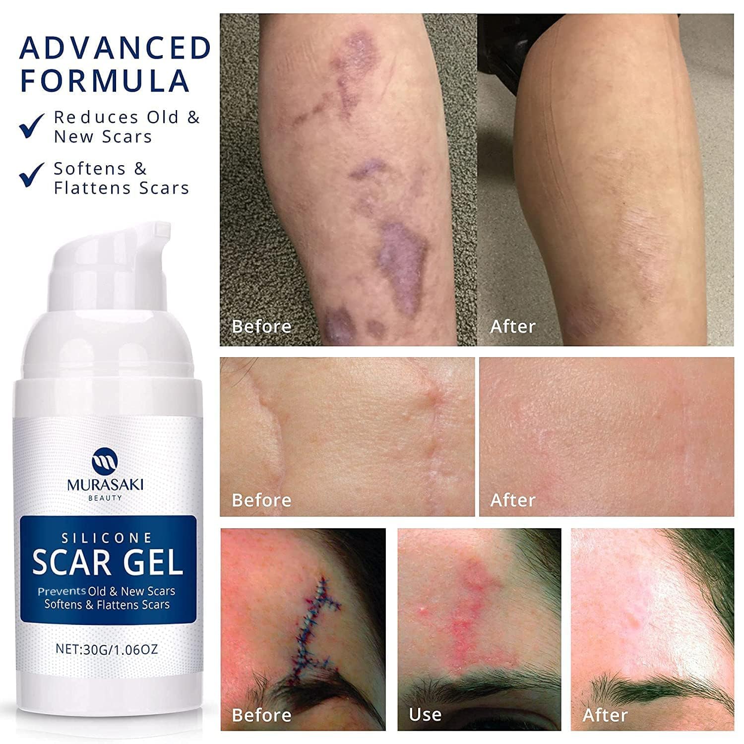 MURASAKI BEAUTY textura de gel ligera que se absorbe rápido