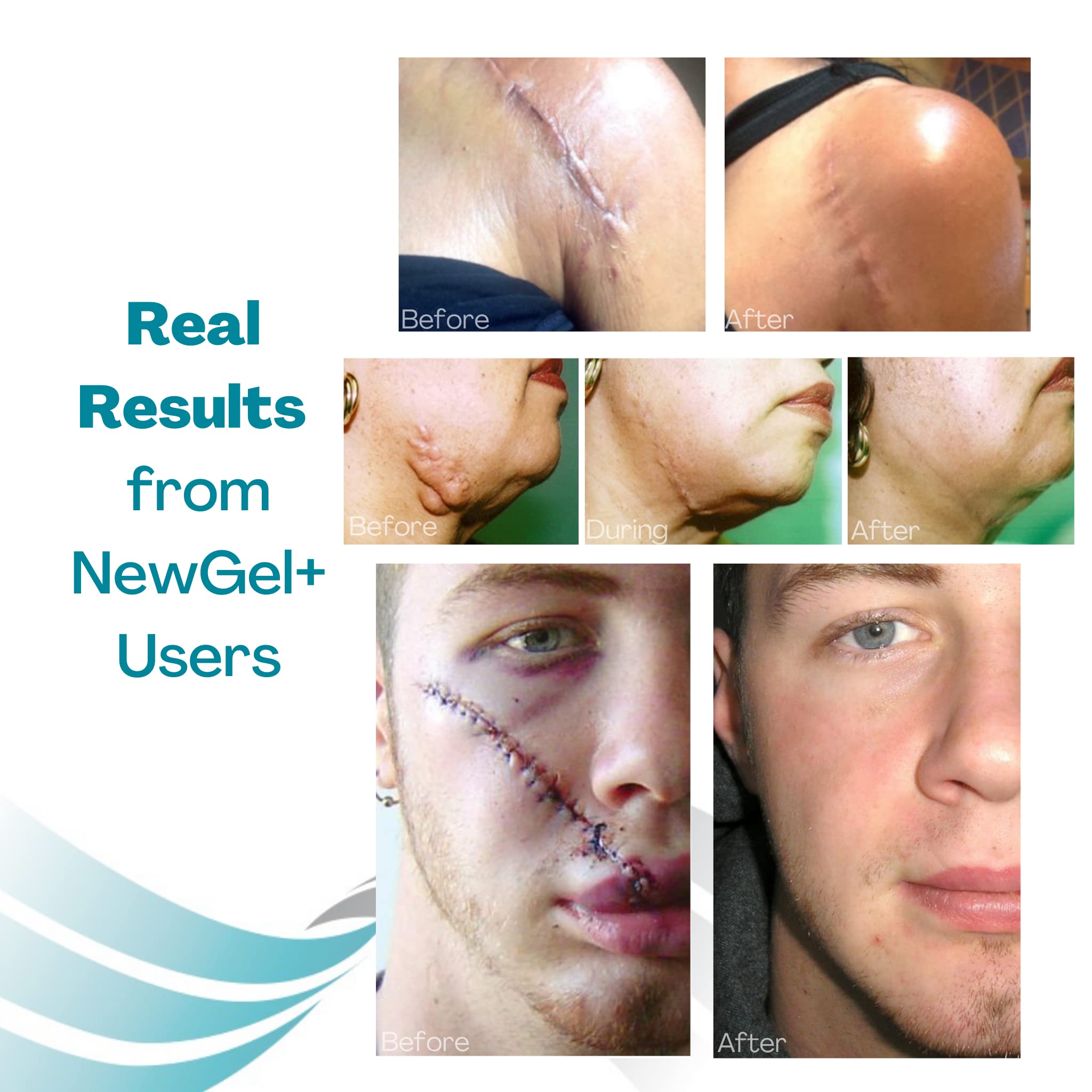 Escena clínica con producto MyNewGel en entorno de recuperación segura