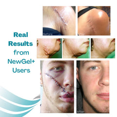 Escena clínica con producto MyNewGel en entorno de recuperación segura