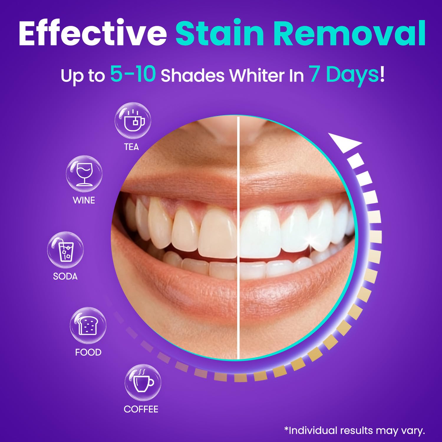 MySmile aplicación de tiras en boca con fácil colocación