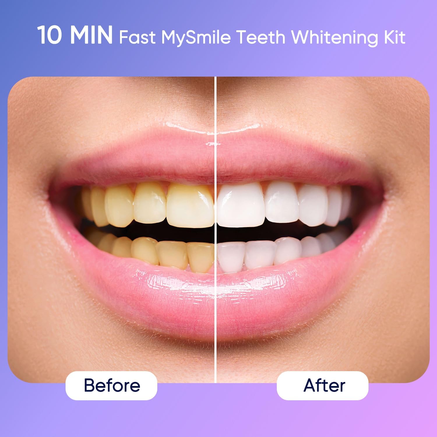 MySmile gel blanqueador textura y color que indica liberación sostenida