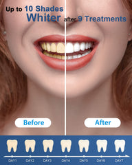 MySmile persona usando bandeja con gel para sonrisa más blanca