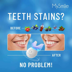 MySmile lámpara LED encendida acelerando el proceso y eficacia