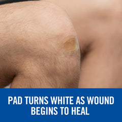 Nexcare comparación de tamaño en mano para visualizar escala real