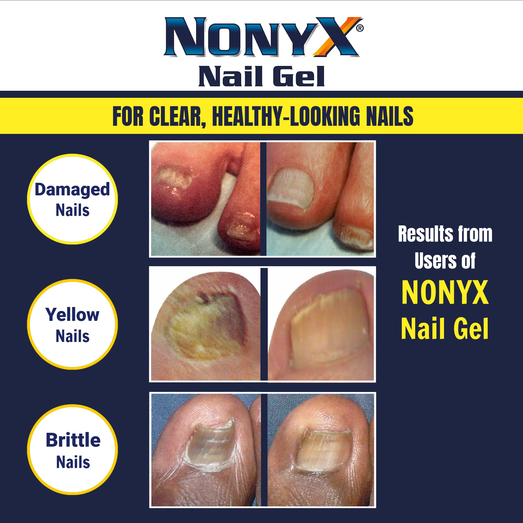 NONYX etiqueta con ingredientes y respaldo clínico visible