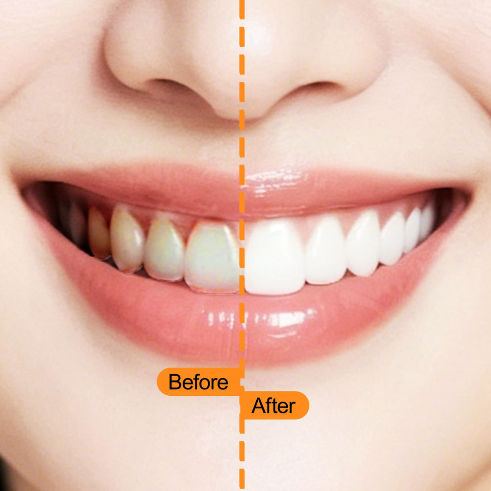 NXPPYY cepillos en bolso de viaje, limpieza interdental móvil