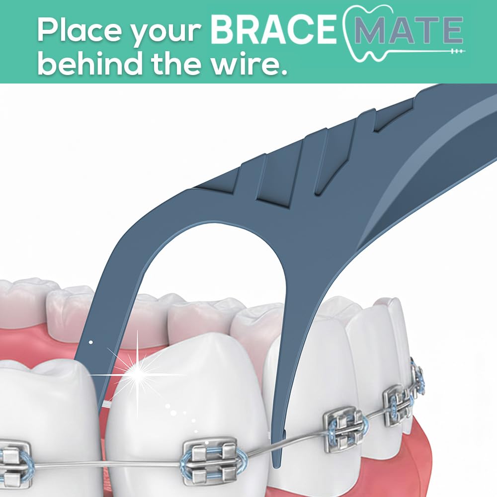 o1brand cepillo de precisión limpiando alrededor de brackets eficaz