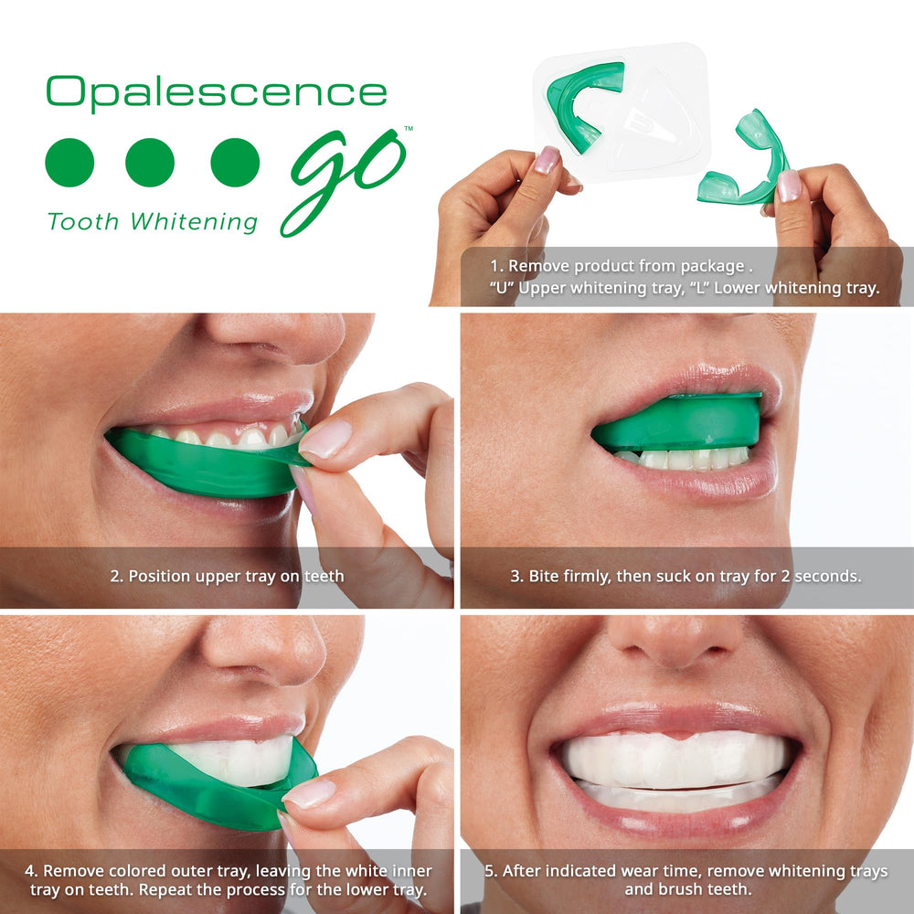 Opalescence férula prellenada con gel visible y ajuste cómodo