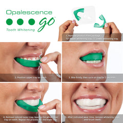 Opalescence férula prellenada con gel visible y ajuste cómodo