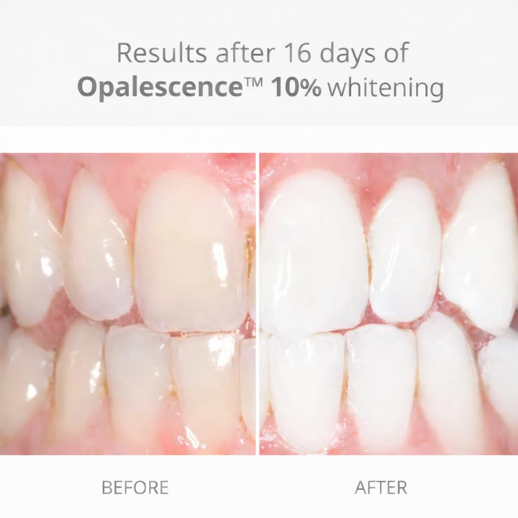 Opalescence jeringa de gel cerca mostrando crema y textura fácil aplicación