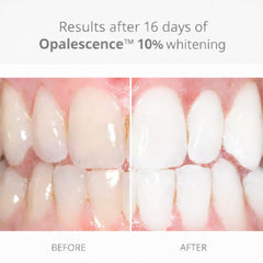 Opalescence jeringa de gel cerca mostrando crema y textura fácil aplicación